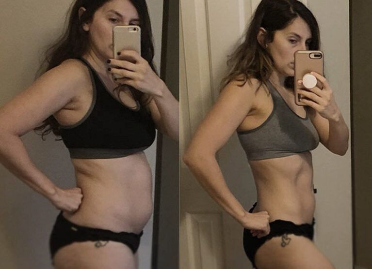 Κορίτσι πριν και μετά τη διατροφή κετο